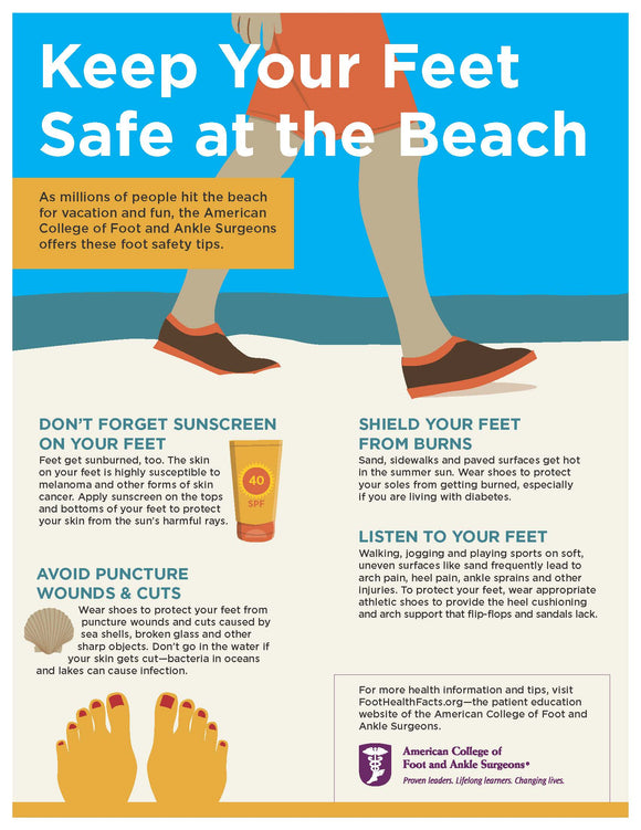 how to wear shoes with sunburned feet